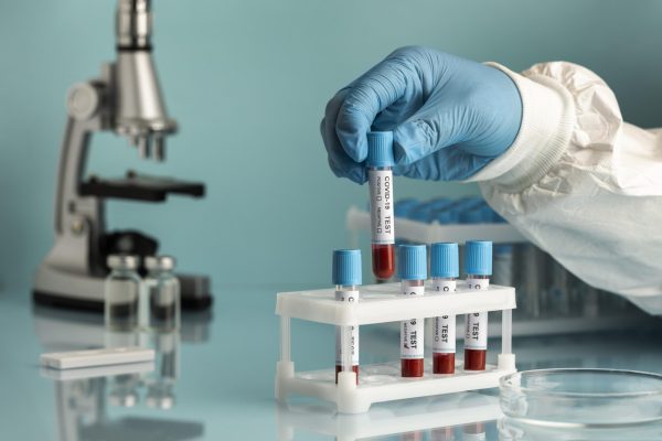 hand-with-protective-gloves-holding-blood-samples-covid-test hand-with-protective-gloves-holding-blood-samples-covid-test